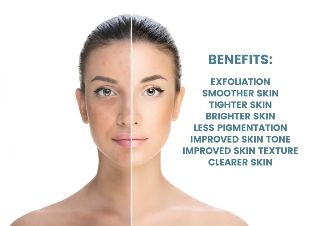 Benefits of Chemical Peels with a Close up of a Woman Face in Two Parts