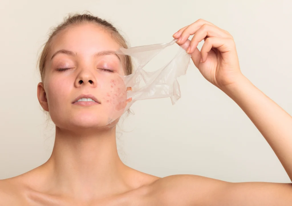 How to Use Face Peels for Scar Treatment: A Comprehensive Guide
