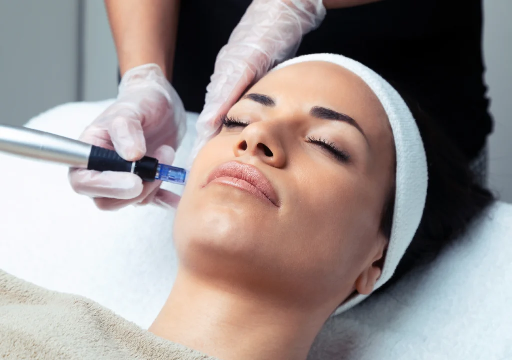 Dermatologist is Using Microneedling Pens on a Woman's Face