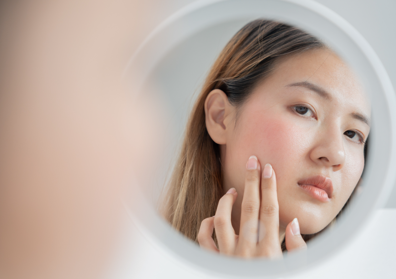 Sad Asian Girl Looking Face Skin in the Mirror with Red Rash on her Face