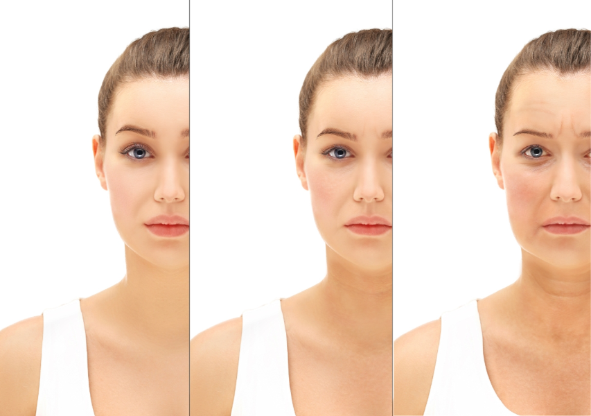 Aging Process of the Skin