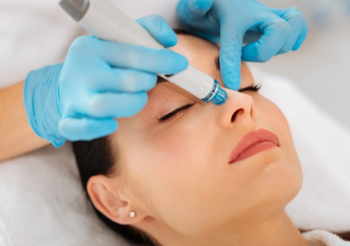 Extraction Hydrafacial Treatment