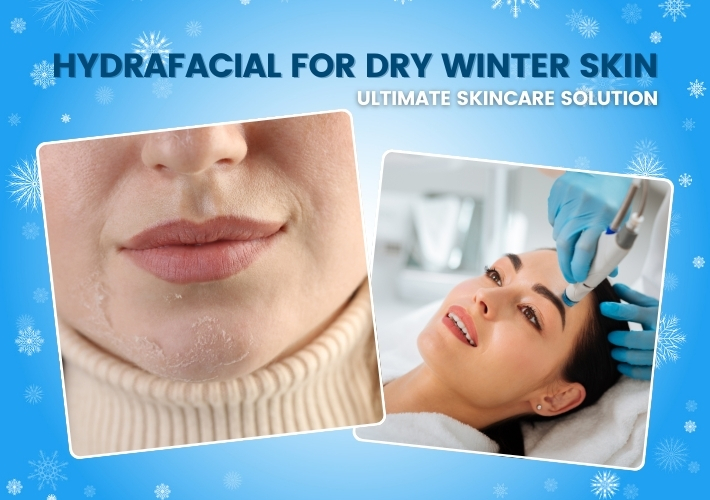 Ultimate Skincare Solution: The Power of Hydrafacial for Dry Winter Skin