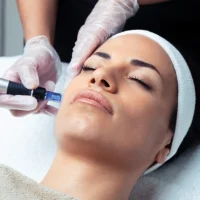 Dermatologist is Using Microneedling Pens on a Woman's Face